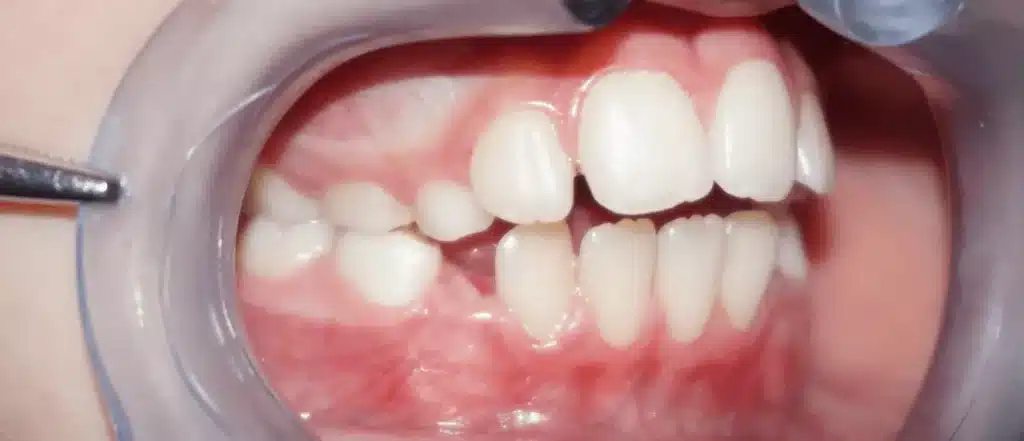 Orthodontist in Paris before