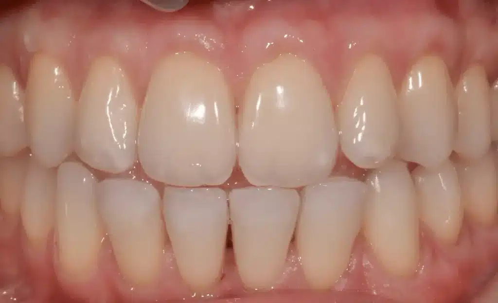 dentiste spécialiste parodontologie après