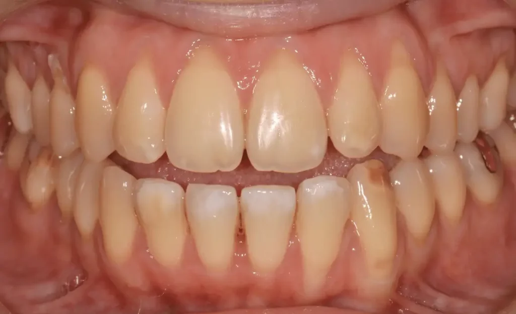 dentiste spécialiste parodontologie avant