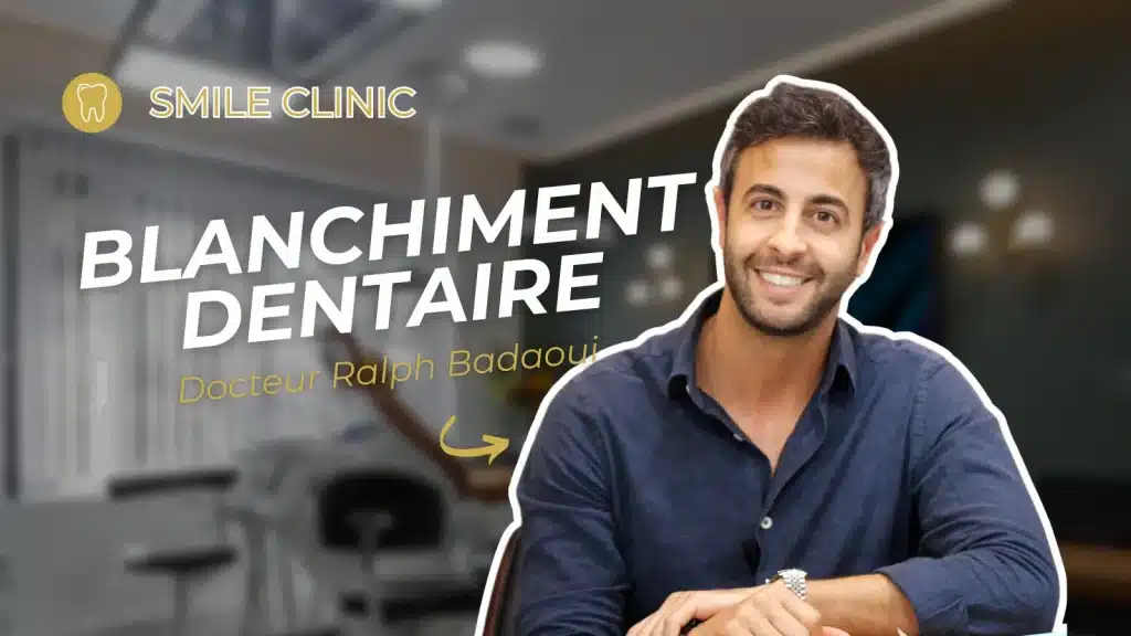 Le blanchiment dentaire à la maison